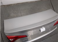  Камера заднего вида Hyundai Sonata LF 2014-2019 11376934 #5