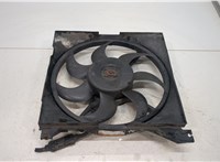  Вентилятор радиатора Hyundai Santa Fe 2000-2006 20429280 #1