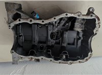 8200318813 Поддон Renault Megane 2 2002-2009 20590212 #3