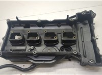 A2710101030 Крышка клапанная ДВС Mercedes C W203 2000-2008 20595112 #3