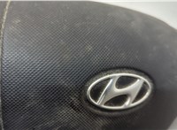 569002C501LK Подушка безопасности водителя Hyundai Coupe (Tiburon) 2002-2009 20597177 #5