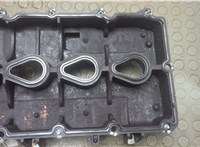 12591996 Крышка клапанная ДВС Hummer H3 21060433 #2
