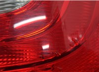  Фонарь (задний) Skoda SuperB 2008-2015 22132368 #2