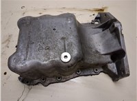 9129316 Поддон Opel Corsa C 2000-2006 9207674 #1