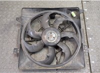  Вентилятор радиатора Hyundai i40 2015- 20294349 #1